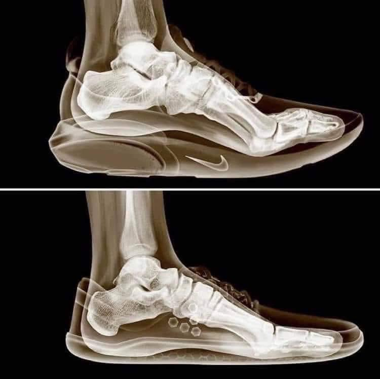 EnergyUp_'s tweet image. Your feet are destroying your entire body.
And modern shoes are making it worse...
Here’s EVERYTHING you need to know about your foot health (and how to protect them): 🧵🧵