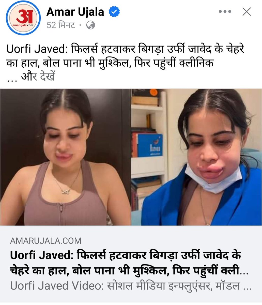 #अमरउजाला को उर्फी जावेद के चेहरे की बहुत चिंता है #स्कूल_मर्ज में बर्बाद हो रहे नौनिहालों के भविष्य पर इनको सांप सूंघ जाता है...#दलाल_मीडिया #आईटीसेल #यूपी_गवर्नमेन्ट #भाण्डमीडिया #दोषी_शिक्षक
