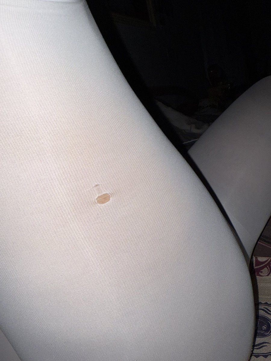 為什麼會破在大腿後面啦…