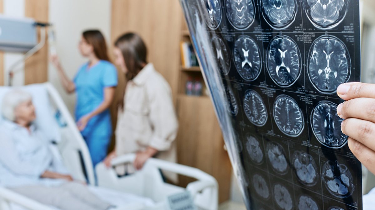 AMAEdHub's tweet image. Minimize the impact of cerebral ischemia and hemorrhagic stroke with effective screening, prevention and treatment. #Physicians, earn CME and familiarize yourself with #stroke risk factors, prevention strategies and treatment options. Learn more.
amaedhub.org/40lXOrG