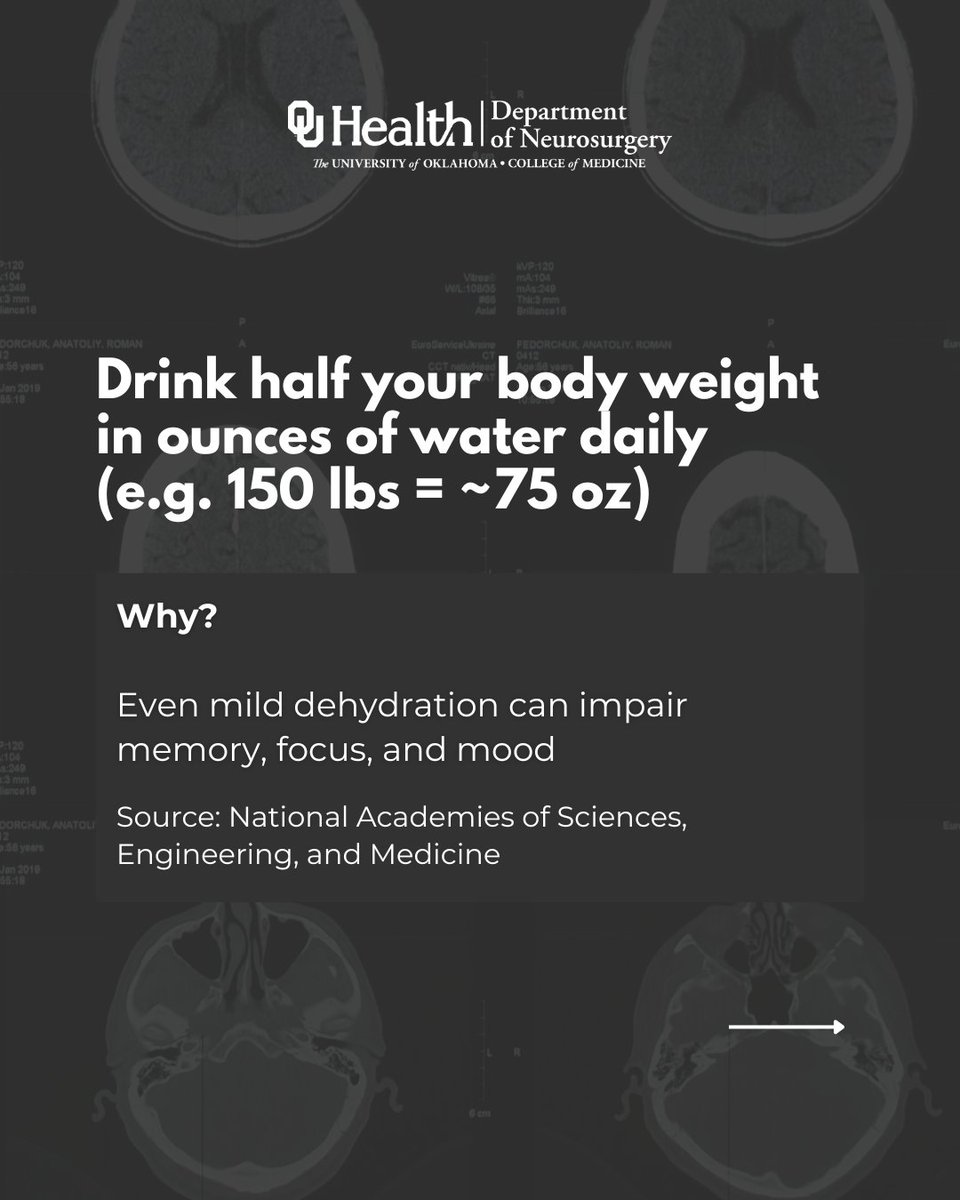 OU_Neurosurgery's tweet image. It’s World Brain Day and your daily habits matter.
Your brain is working 24/7 to help you move, think, remember, and feel.
So how do you take care of it?
Start small with habits proven to support long-term brain health.
👉 Swipe through to learn how and why.
#WorldBrainDay