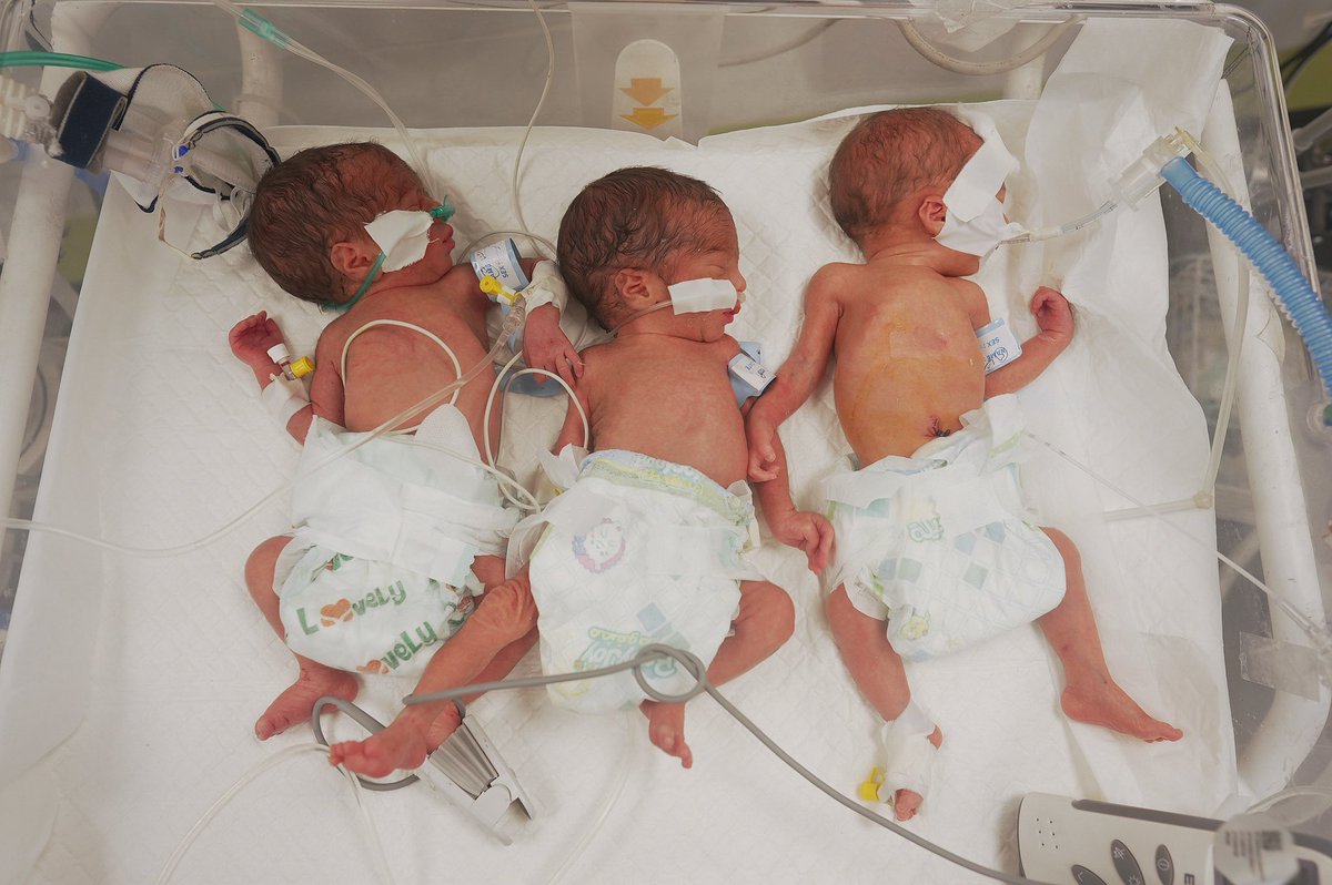 UNFPA_ASRO's tweet image. 🚨 In #Gaza, pregnant women are starving. Some weigh less than 40kg.
1 in 3 pregnancies is high-risk.
Women are giving birth without food, water, or medical care.
Newborns are dying from hunger and neglect.
This is not a crisis — it’s a humanitarian collapse.
#CeaseFireNow