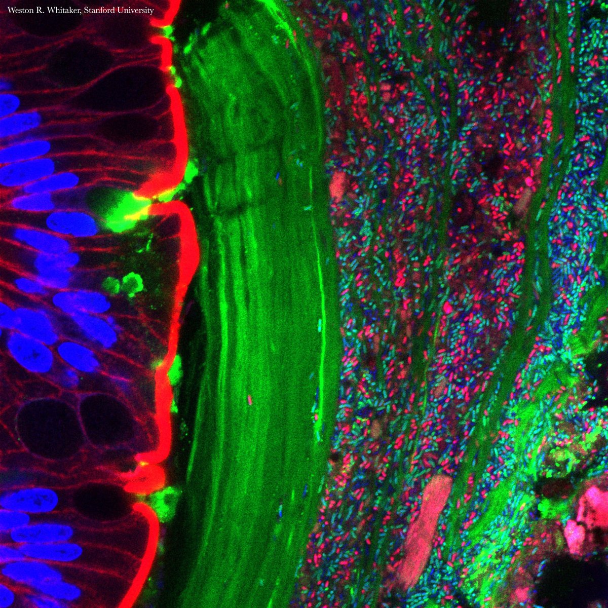 ScienceMagazine's tweet image. Engineered gut bacteria designed to treat kidney stones successfully colonized the gut microbiome and reduced oxalate levels in animal models and early clinical trials in humans, researchers report in Sciece.
The findings offer a promising, yet still imperfect, step toward…