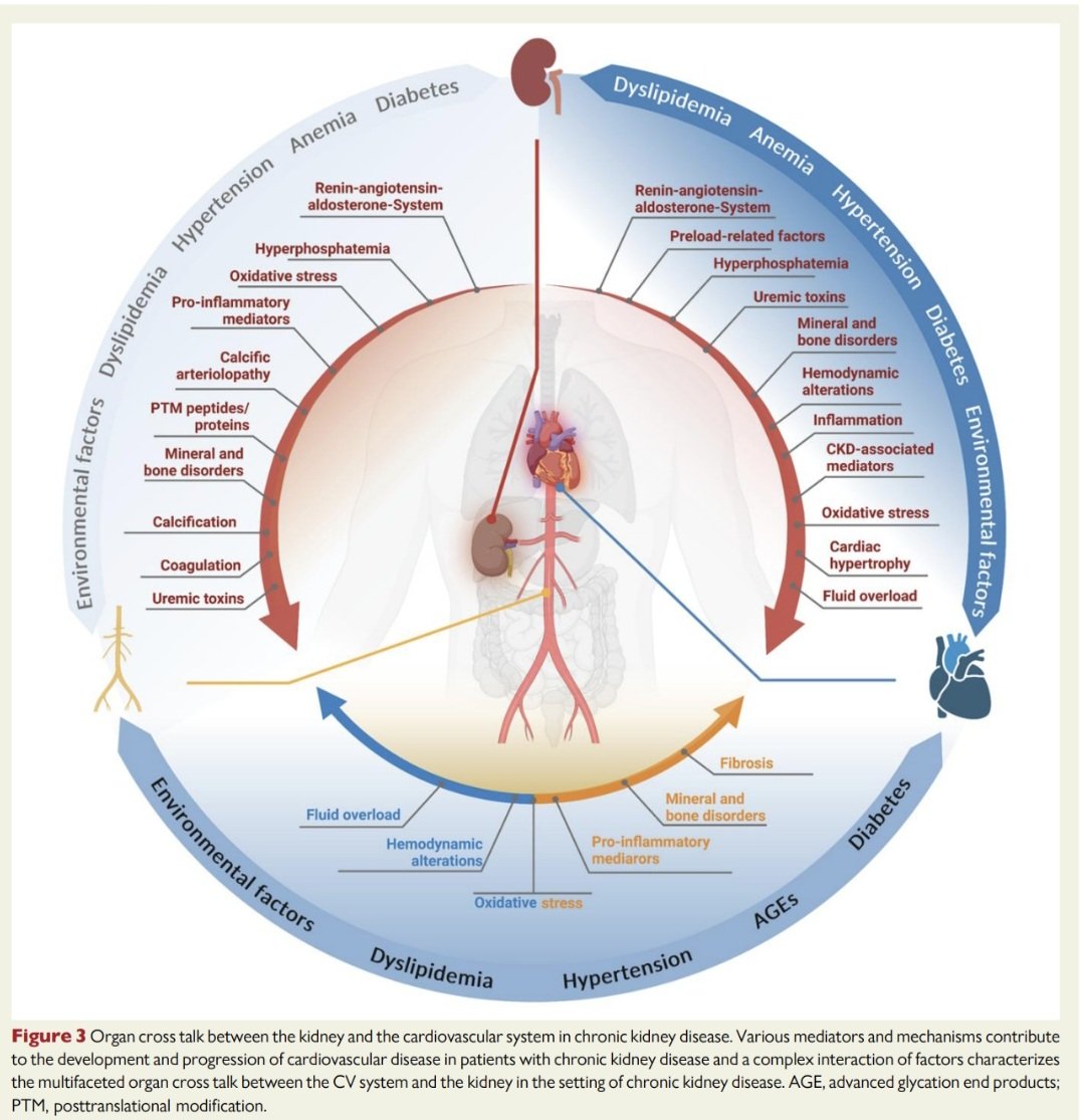 javier20ch's tweet image. Enfermedad Cardiovascular en la Enf. Renal Crónica. 🫀💥
🔶️El desarrollo de Enf. CV en la ERC es un proceso complejo y multifactorial causado por factores de riesgo tradicionales como la hipertensión, DM2, dislipidemia; así como factores asociados a la ERC como la inflamación,…
