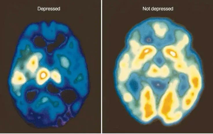 You’re not depressed.

Your nervous system is dysregulated and stuck in a freeze state.

That’s why everything feels heavy, numb, and pointless, even when life is “fine.”

Here’s how trauma creates shutdown (and how to start feeling better): 🧵