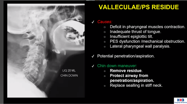 ESHNRSociety's tweet image. ESHNR Webinar
Snapshots from the interesting cases
Speaker: Martin Ferraro, Buenos Aires/AR
Moderator: Salman Qureshi @SalmanQureshiDr, Abu Dhabi/AE