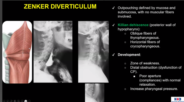 ESHNRSociety's tweet image. ESHNR Webinar
Snapshots from the interesting cases
Speaker: Martin Ferraro, Buenos Aires/AR
Moderator: Salman Qureshi @SalmanQureshiDr, Abu Dhabi/AE
