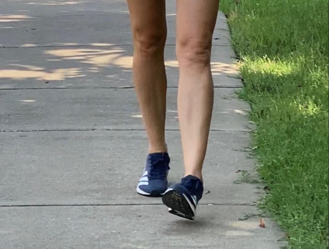 anasalduhishy's tweet photo. It’s not mental, it’s neurological! 

A rare, task-specific movement disorder where the body “forgets” how to run smoothly 

It’s Runner’s dystonia 

#Dystonia #RunnerProblems #Neurology https://t.co/NyWpDIN8U4