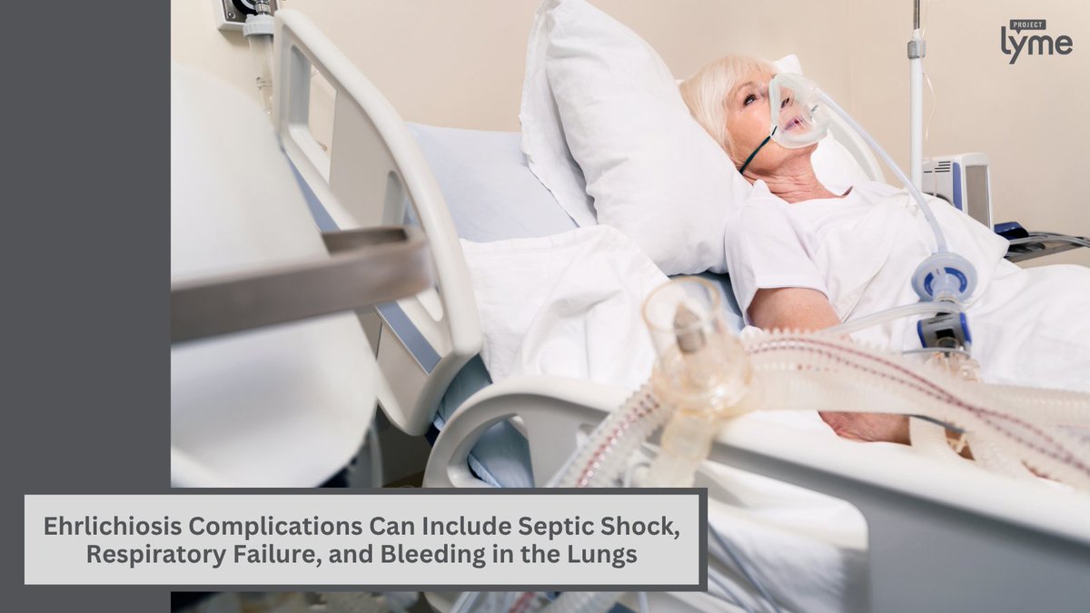 ProjectLyme's tweet image. 75-year-old woman from NC had septic shock, respiratory failure & bleeding in the lungs. Her doctors learned that the patient had been exposed to ticks via her pet cat while gardening, and a PCR test came back positive for ehrlichiosis. Via @CureusMedical cureus.com/articles/38335…