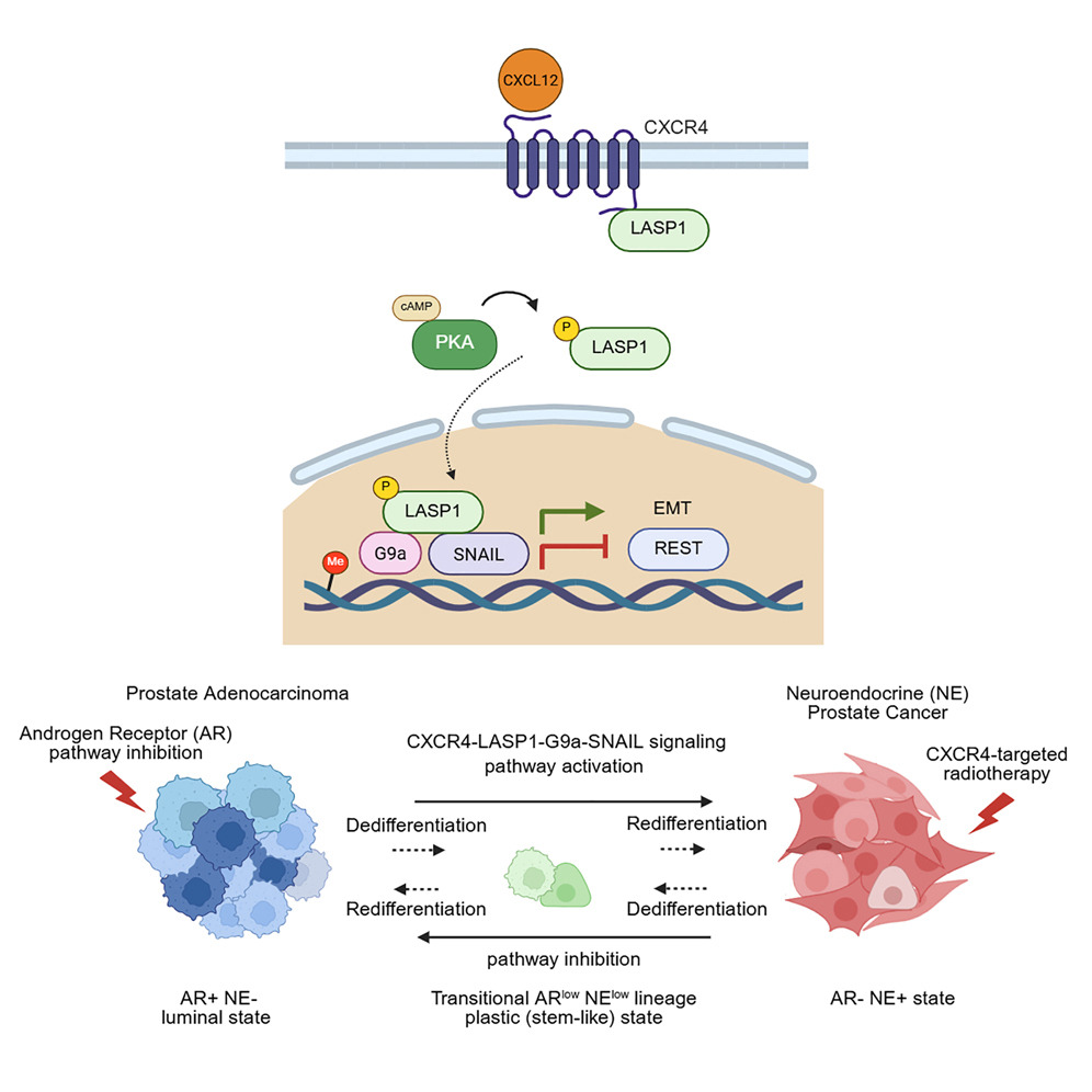 ScienceVancity's tweet image. The @frbenard, @yuzhuo_wang, and Ong labs at @BCCancer, @VanProstateCtr, and @UBC have identified a key regulator of epigenetic and transcriptional reprogramming in neuroendocrine prostate cancer (#NEPC) transdifferentiation.

🖇️ Abstract in @CellGenomics: bit.ly/3TJx3K1