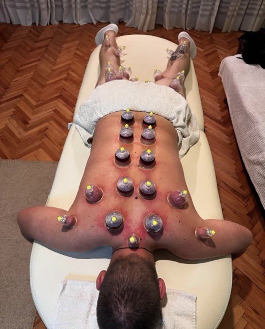 RebeccaTalbot02's tweet photo. Another successful detox session complete — and one more happy client! 🙌
Thank you for trusting me with your wellness journey.

📩 Book your appointment today!

#CuppingTherapy #CuppingMassage #DetoxNaturally #WellnessCare #DMToBook #HolisticHealing https://t.co/Z8DpZoTUh7