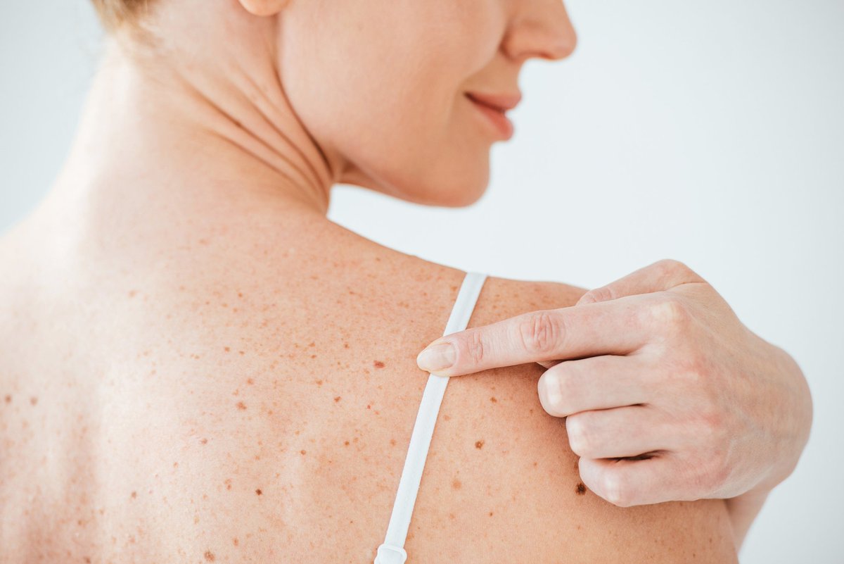 VCUMassey's tweet image. Soaking up the summer vibes? Don't forget your sunscreen! ☀️ We're all about enjoying those bright days, but sun safety is key to keeping your skin happy and healthy. Here are some quick tips on how to protect yourself from harmful UV rays this season! masseycancercenter.org/news/understan…
