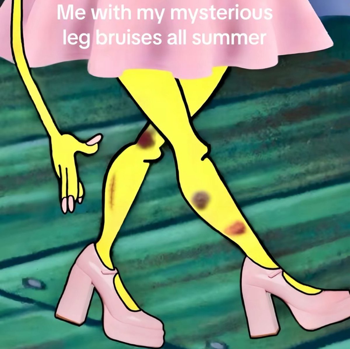 kızlar ve nerden geldiklerini bilmediği bacak morlukları