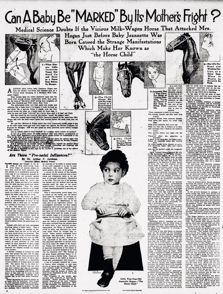 oddoldnews's tweet image. Can A Baby Be "MARKED" Bylis Mothers Fright ?
The Washington times. March 28, 1920
