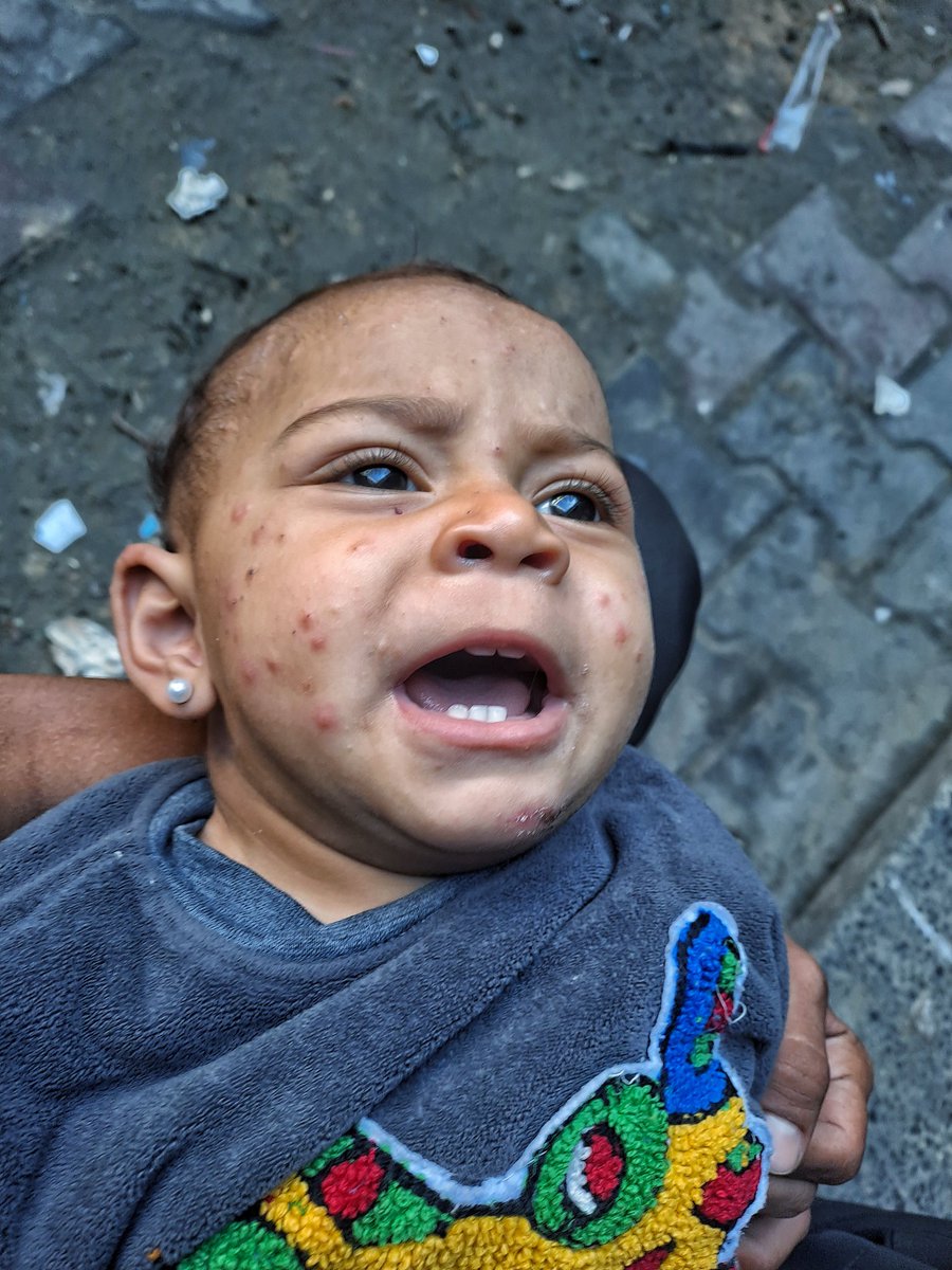 mahmoud60013's tweet image. Today, the death toll from hunger in Gaza has risen to 86 lives. 86 lives that could have been saved with food, compassion, and action. My heart breaks. For Tasneem, for being malnourished. For not having food. I cannot describe how helpless I feel. His voice echoes in my mind.…
