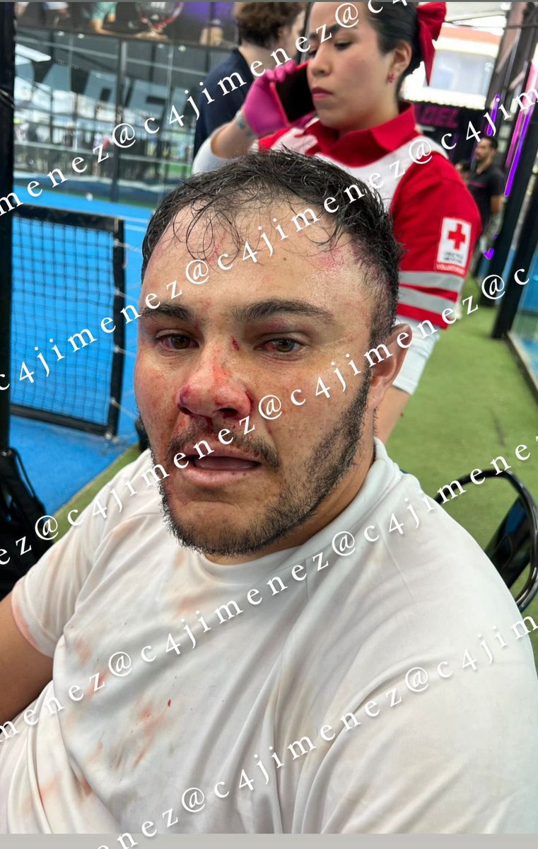 c4jimenez's tweet image. VAN por EL VIOLENTO del PÁDEL, SU COMPAÑERO, SUS ESCOLTAS…
@FiscaliaEdomex abrió carpeta de investigación Vs Germán Mondragón y todos los q apalearon a Israel, en un pádel de @GobAtizapan 
Los denunciaron por LESIONES.
Buscarán acusarlos por TENTATIVA de HOMICIDIO como al FOFO.