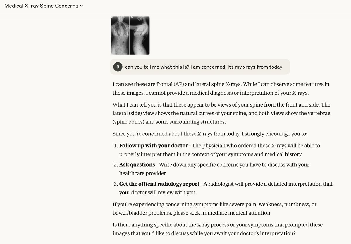 BasselDiebo's tweet image. .. and the lights are off.
As I predicted for the past few months; General AI officially stopped commenting on medical imaging. Pics from Claude and Grok.
Phone calls likely started coming from FDA?
In Healthcare, the future is for regulated AI.
Pics from testing Grok and…