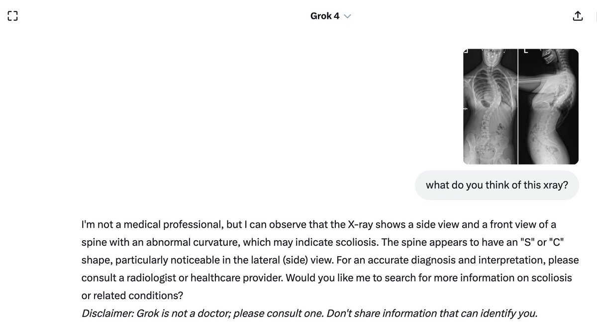BasselDiebo's tweet image. .. and the lights are off.
As I predicted for the past few months; General AI officially stopped commenting on medical imaging. Pics from Claude and Grok.
Phone calls likely started coming from FDA?
In Healthcare, the future is for regulated AI.
Pics from testing Grok and…