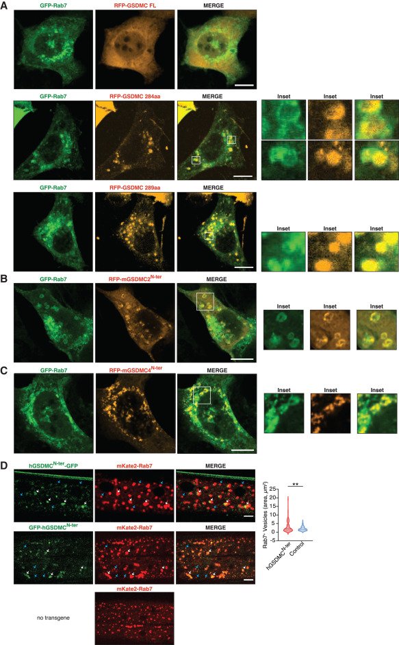 LabWaggoner's tweet image. Gasdermin C cleavage by Cathepsin S modulates Rab7 vesicles in intestinal epithelial cells to amplify anti-helminth immunity @ImmunityCP @surya25_pandey @YinanGong @RH_Laboratory
cell.com/immunity/fullt…