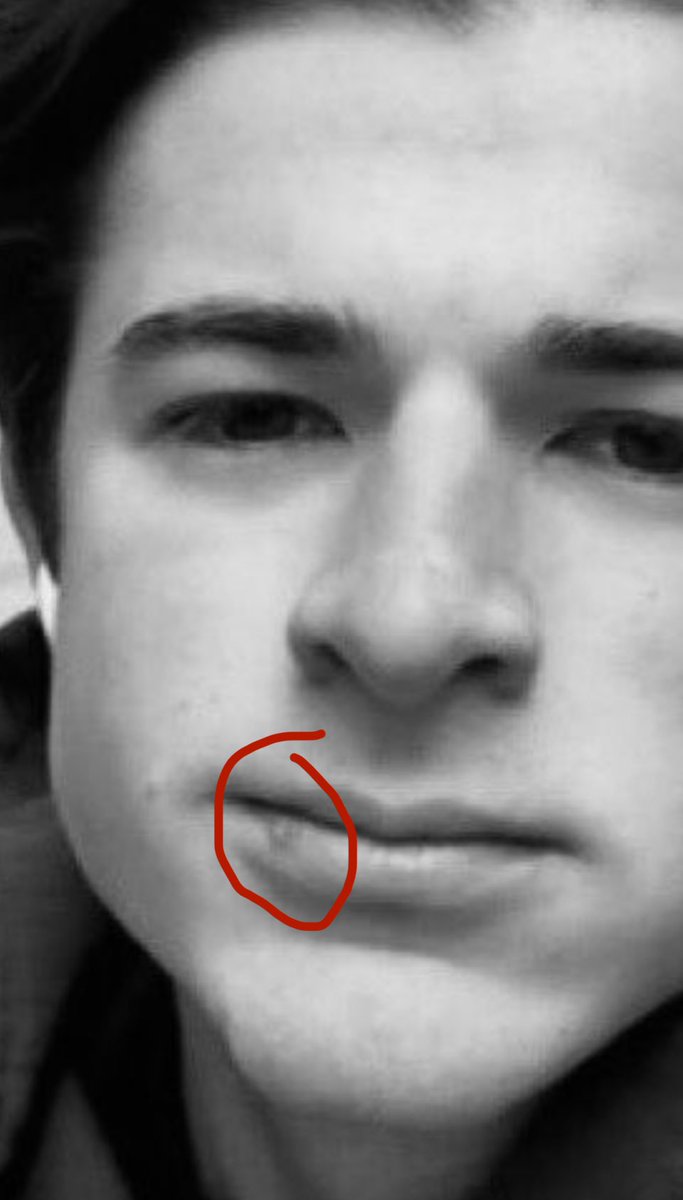 sovey_X's tweet image. Herpes is 124% more prevalent in gay men.
I’ve officially settled the debate if Harry is straight or not.
You’re welcome.