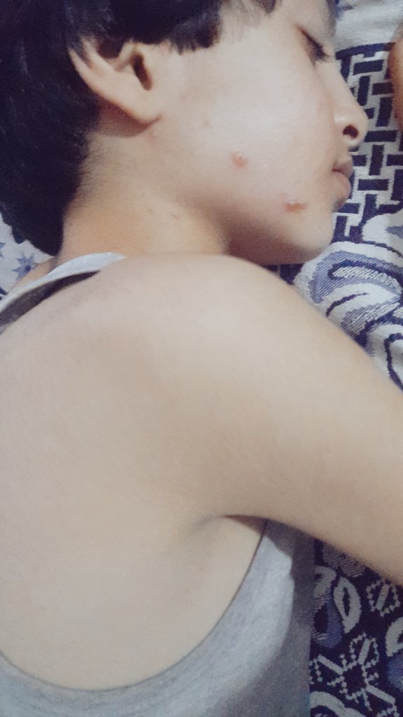 Wafaa90H's tweet image. My child has chickenpox and severe malnutrition.
We have no food. We are living a real famine.
Please help us.
gofund.me/4d2039fb
#Gaza #HelpChildren #EmergencyAid #SaveLives