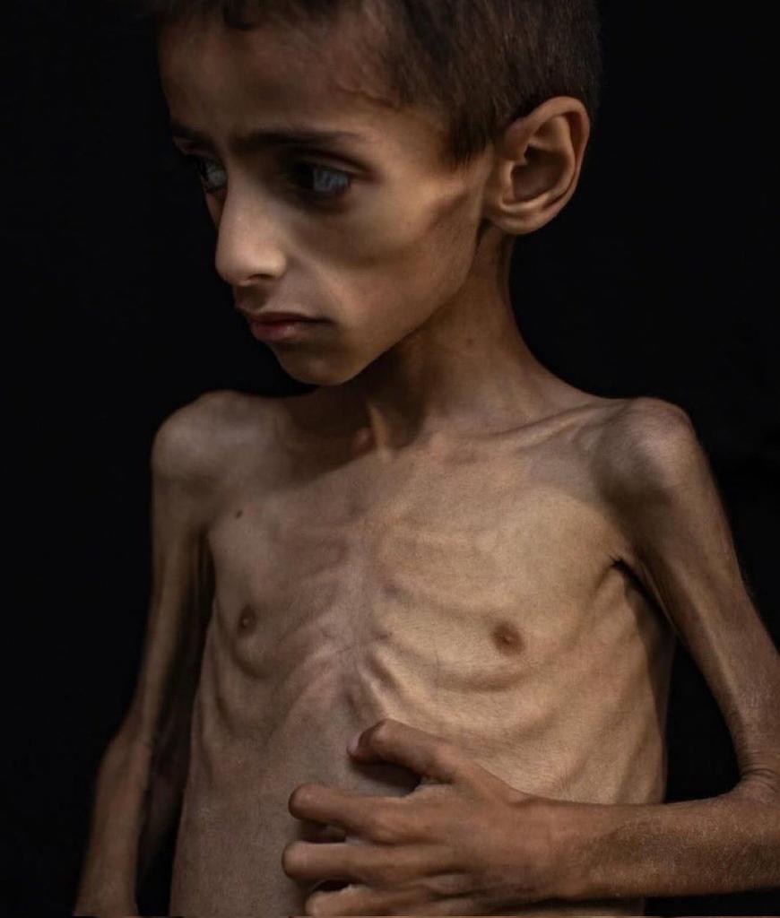 #انقذوا_غزة_بفتح_المعابر 
#غزه_تموت_جوعاً