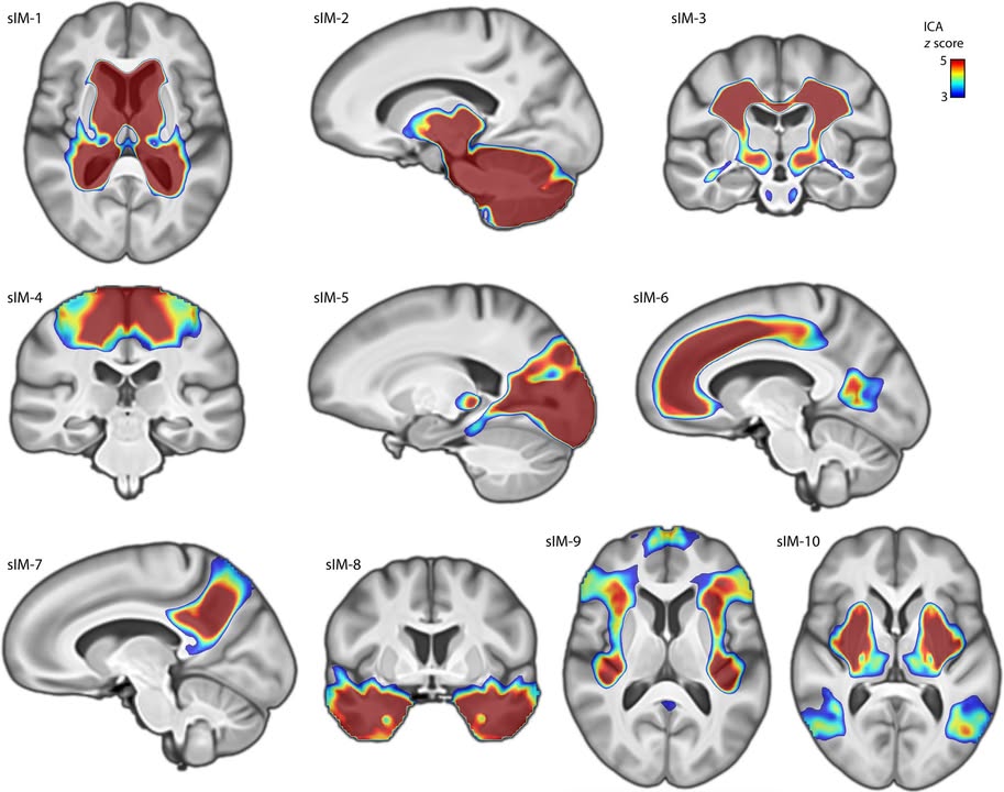 ScienceMagazine's tweet image. A 2024 @ScienceAdvances analysis involving data from more than 35,000 adults with dyslexia has revealed structural differences in the brain that correlate with a genetic predisposition to dyslexia.
Learn more on #WorldBrainDay: scim.ag/3TRaAuz