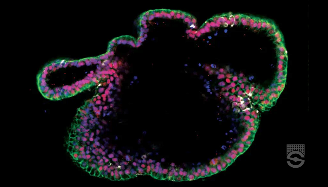 PancreaticCell's tweet image. Learn how to dissociate PSC-derived #epithelial cultures grown in 2D/3D formats into single cells with this collection of optimized protocols from @STEMCELLTech. 📃
bit.ly/4kxjvwC