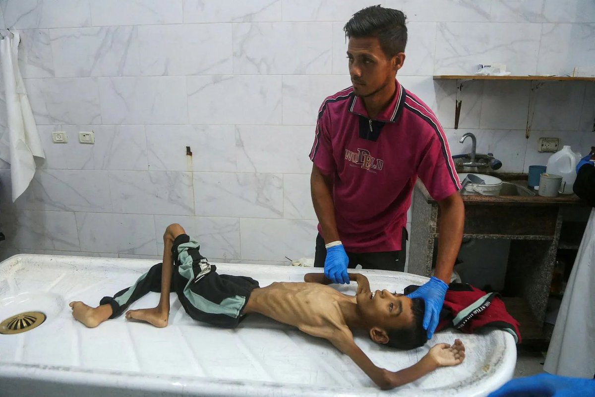 A medic cleans the body of Palestinian youth Abdul Jawad al-Ghalban, 14, who died of starvation at the Nasser hospital morgue in Khan Yunis in the southern Gaza Strip on Tuesday. AFP/-