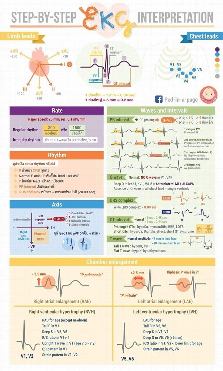 🔴A step-by-step guide to Electrocardiogram (EKG) interpretation, covering various aspects of EKG analysis:⤵️🔹 

 #Cardiology #FOAMed #MedEd #medstudent #paramedic #Cardiology #CardioEd #medtwitter #meded #CardioTwitter #cardiotwiteros  #MedX #cardiovascular