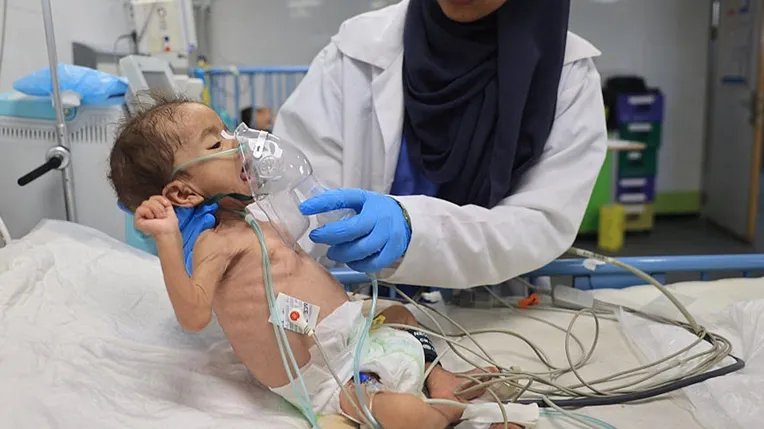 أعلن مستشفى الشفاء عن وفاة 71طفلا خلال 72  ساعة
#غزه_تموت_جوعاً