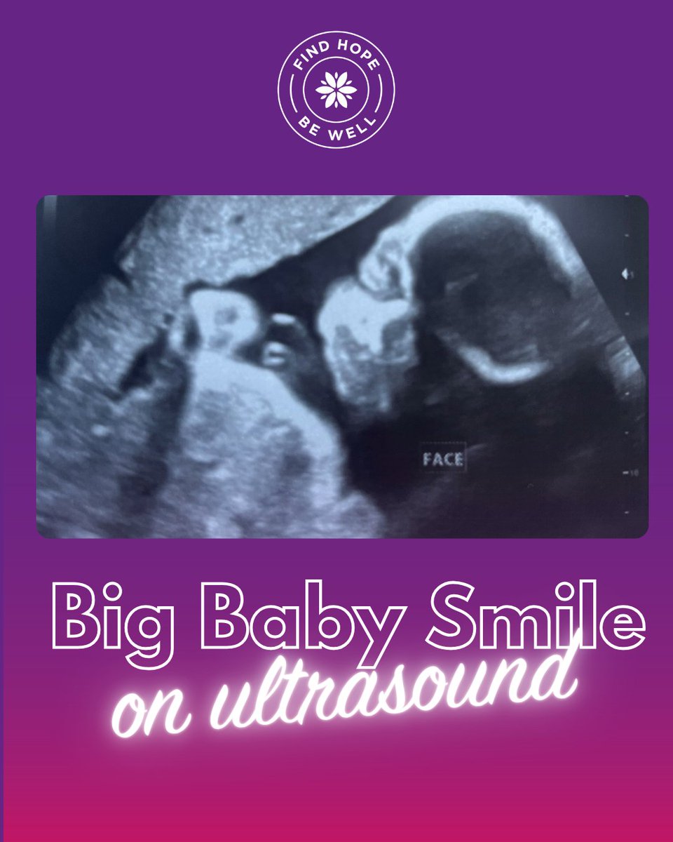 StantonIntl's tweet image. Look at that big baby smile! 🥹💗
Even before birth, life is full of wonder. At Stanton, we offer free ultrasounds, support, and hope — because every heartbeat matters. 💜
#StantonHealthcare #ProLife #BigBabySmile #UltrasoundJoy