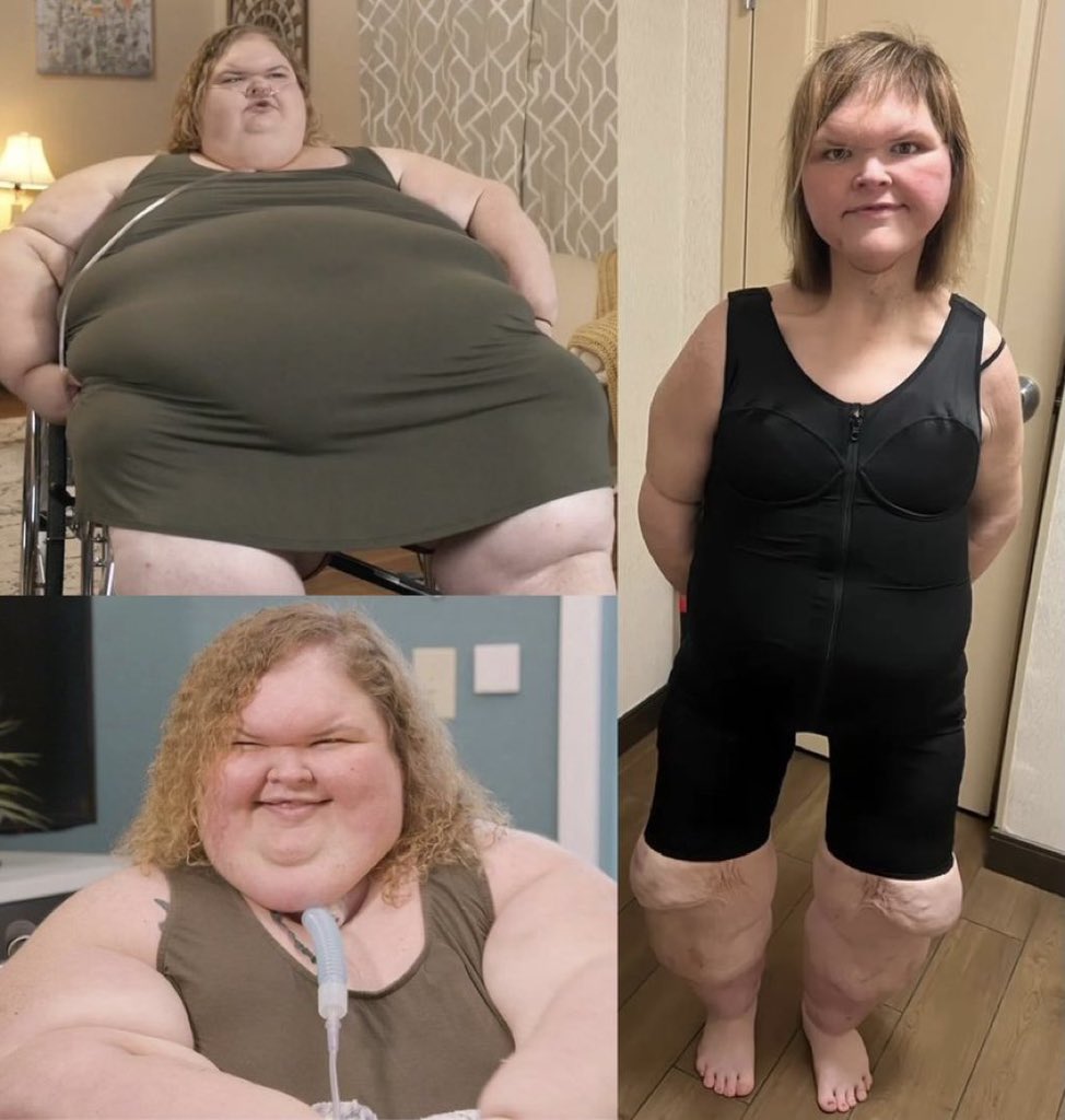 magafan1776's tweet image. Tammy Slaton, star of 1000-lb Sisters, is barely recognizable after extreme weight loss and skin removal surgery.