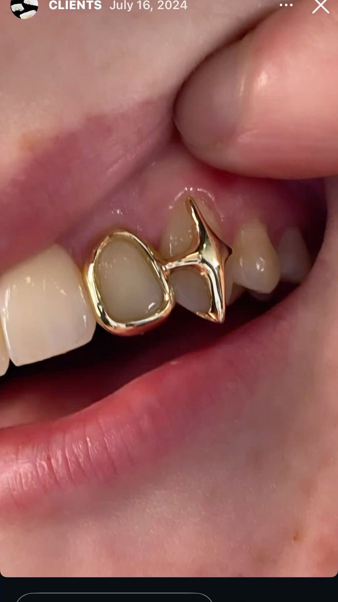 GoIdenLeopard's tweet image. Thinking about modern alternate universe Mel Medarda with a golden grill.