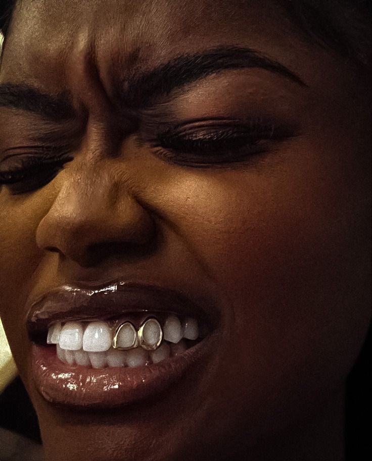 GoIdenLeopard's tweet image. Thinking about modern alternate universe Mel Medarda with a golden grill.