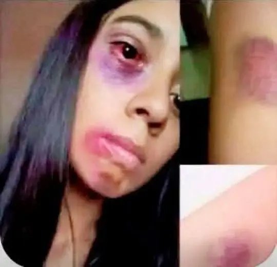 कुछ नहीं‌ कुछ नही 
ये भी पंचरछाप से इश्क लड़ा बैठी थी... 
और बोलती थी मेरा अब्दुल ऐसा नहीं है लेकिन इस मूर्ख और बदजात को नही पता 
अब्दुल हो या आफताब सबने पढ़ी है एक ही किताब
हिन्दू बहनों अभी भी वक्त है सुधर जाओ🙏🏼