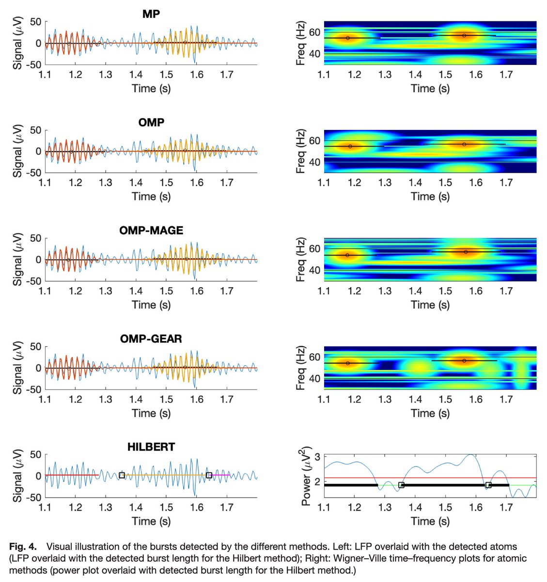 ImagingNeurosci's tweet image. New paper in Imaging Neuroscience by Abhishek Anand, Chandra Murthy & Supratim Ray:
Burst estimation through atomic decomposition (BEAD): A toolbox to find oscillatory bursts in brain signals
doi.org/10.1162/IMAG.a…