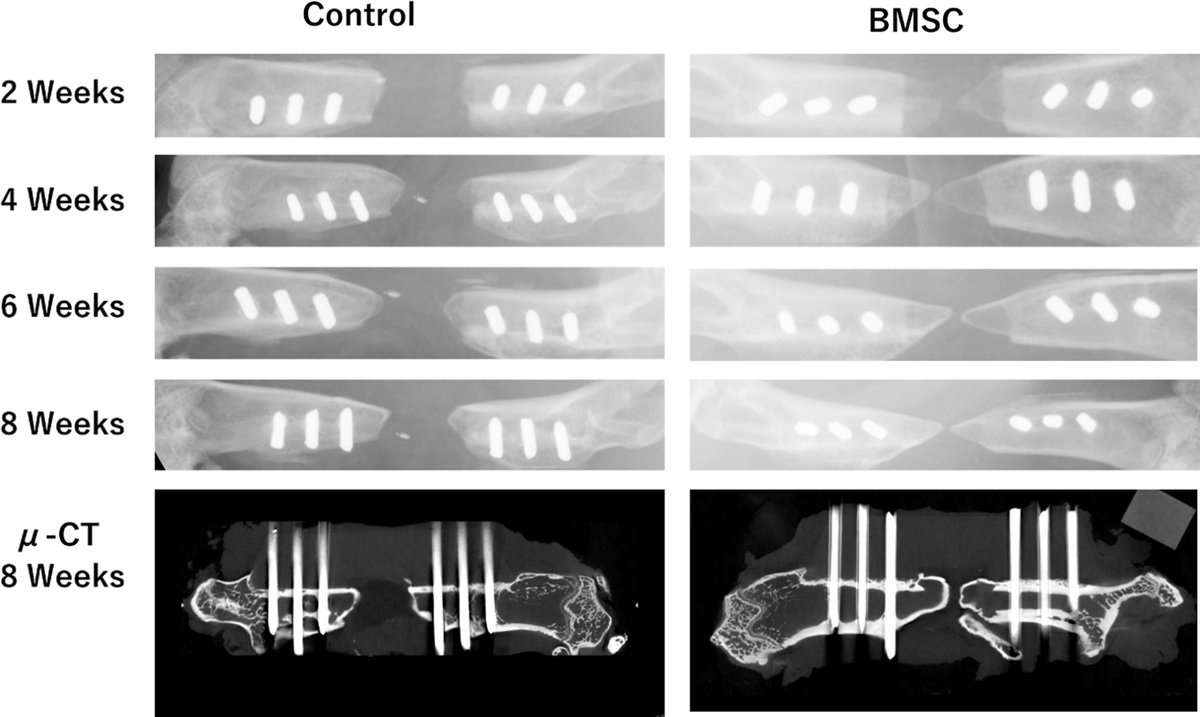 Tissue Engineering (@tissueengin) on Twitter photo Check out this recent article from <a href="/Stanford_Ortho/">Stanford Orthopaedics</a> on how scaffold-free bone marrow-derived mesenchymal stem cell sheets enhance bone formation in a weight-bearing rat critical bone defect model!
Read more here: doi.org/10.1089/ten.te… Check out this recent article from <a href="/Stanford_Ortho/">Stanford Orthopaedics</a> on how scaffold-free bone marrow-derived mesenchymal stem cell sheets enhance bone formation in a weight-bearing rat critical bone defect model!
Read more here: doi.org/10.1089/ten.te…
