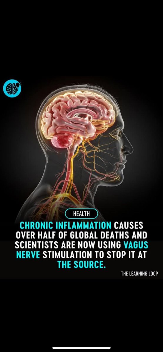 505Cali2's tweet image. Chronic inflammation is one of the most underestimated killers in modern medicine, linked to over half of all global deaths. From heart disease and diabetes to cancer and autoimmune conditions, it silently fuels the most dangerous illnesses we face.