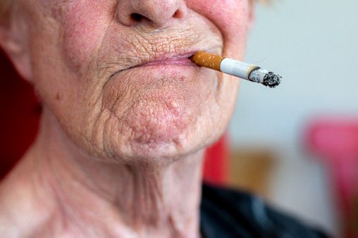 unwisewhiteboy's tweet image. Research on Cigarette Health Effects Proved Menthol Smokers are Uniquely Retarded and a Danger to Themselves and Their Children
follow: @PemisNews