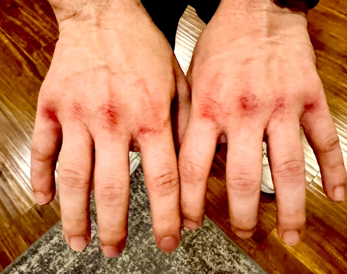 jesusrglez's tweet image. My boxing and sparring 🥊 doesn’t seem to help my piano 🎹 playing 🥴