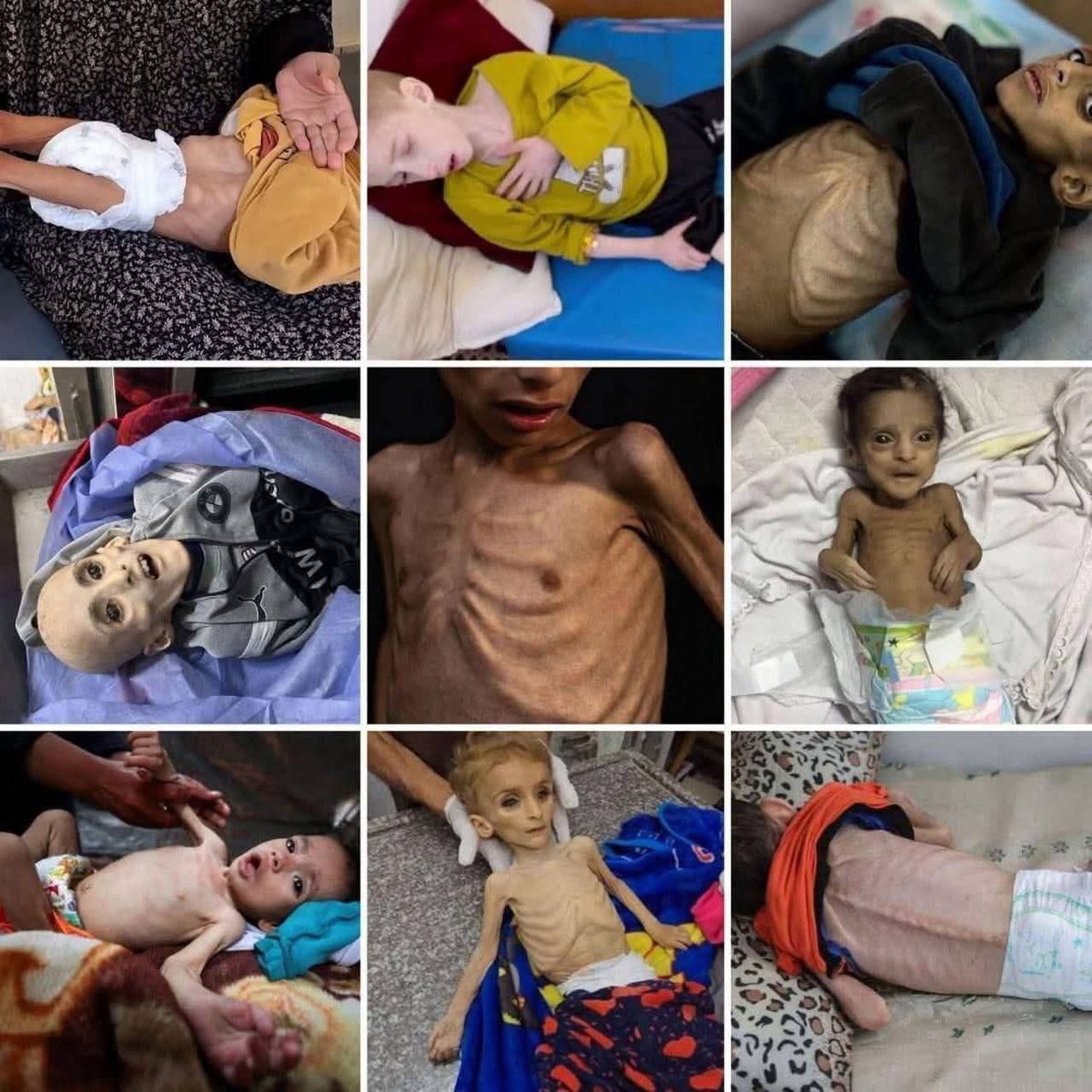 Gaza_Gaza2023's tweet image. More than 70 child martyrs ascended to heaven due to hunger.
#Gaza
#GazaStarving
#GazaHolocaust
#غزة
#غزه_تموت_جوعاً
#غزه_تباد_وتحرق
#غزة_تقتل_جوعاً