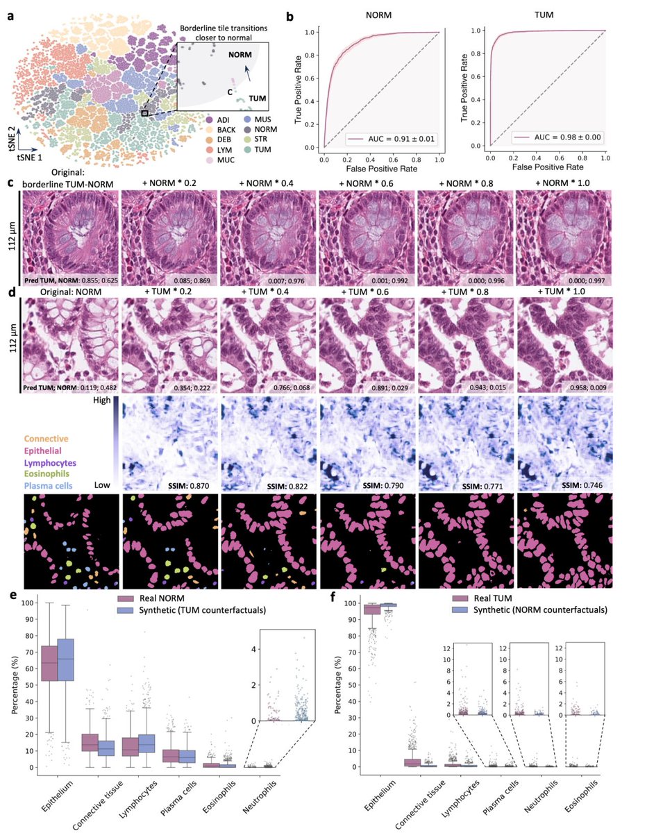aipulserx's tweet image. Can foundation models truly decode single-cell biology, or do they fall short of learning generalizable cellular representations?@biorxivpreprint @tudresden_de
"Counterfactual Diffusion Models for Interpretable Morphology-based Explanations of Artificial Intelligence Models in…