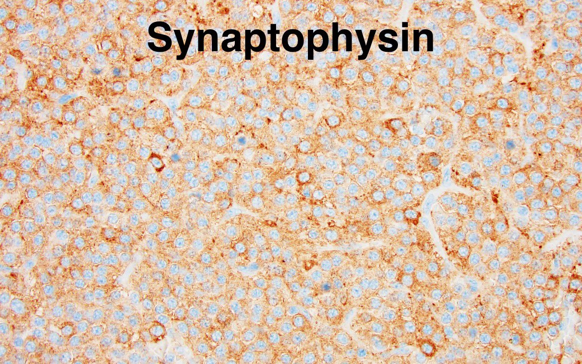 Jared T. Ahrendsen MD, PhD (AP/NP/FP) tweet media