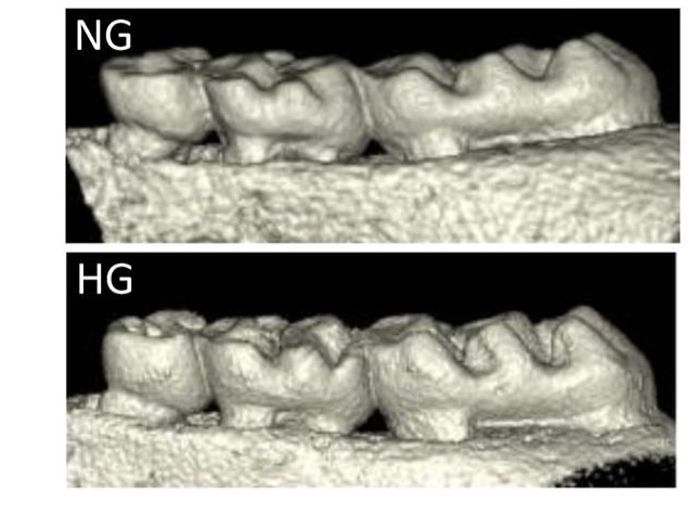 MucosalImmunol's tweet image. #Diabetes can be associated with #periodontal disease; here scRNA profiling identifies immune cell population shifts in diabetes associated mucosal inflammation:
mucosalimmunology.org/article/S1933-…