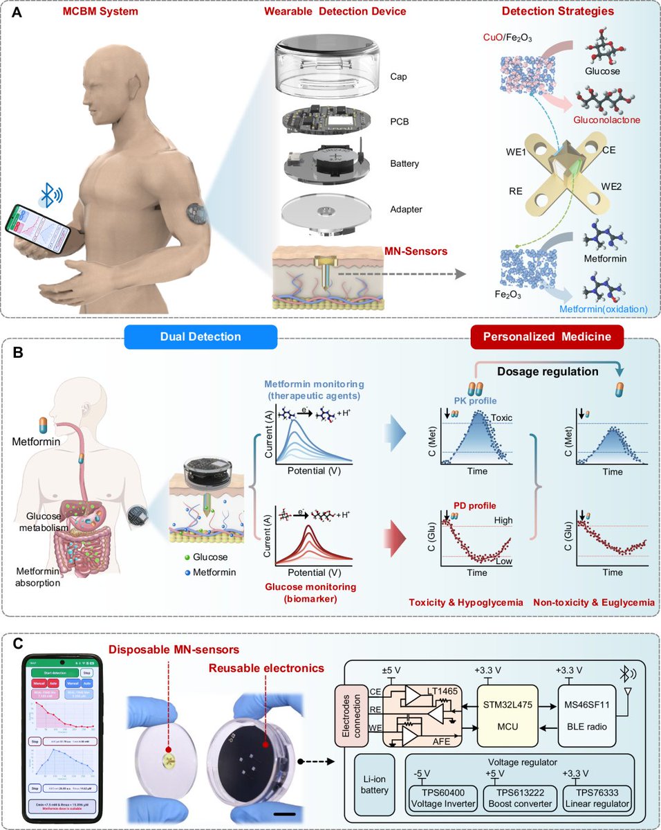 ChinaScience's tweet image. Chinese and Israeli scientists have developed a painless wearable device that monitors blood sugar and adjusts diabetes medication in real time. The patch uses microneedles to track glucose and metformin drug levels under the skin, and can be connected to a smartphone app that…