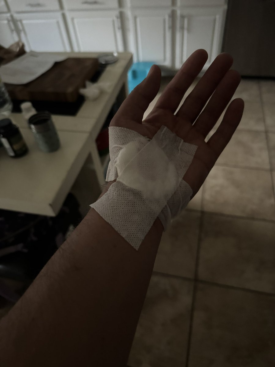 rockets4all2's tweet image. My left hand had 3 failed Iv’s, 1 good one during my surgery on my right leg today. When I got home I accidentally cut it open with a knife when cooking. I still got some code out today. No executes.