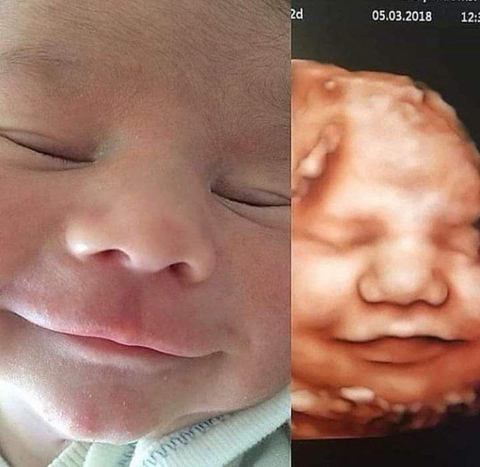 Baby. Before and after birth.