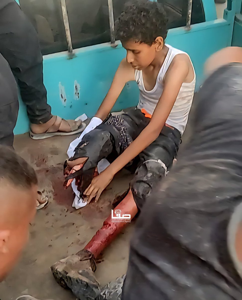 PeaceLiiily2's tweet image. This is the "civilized" west
This is what American empire does to kids in the east.
Shame on @realDonaldTrump