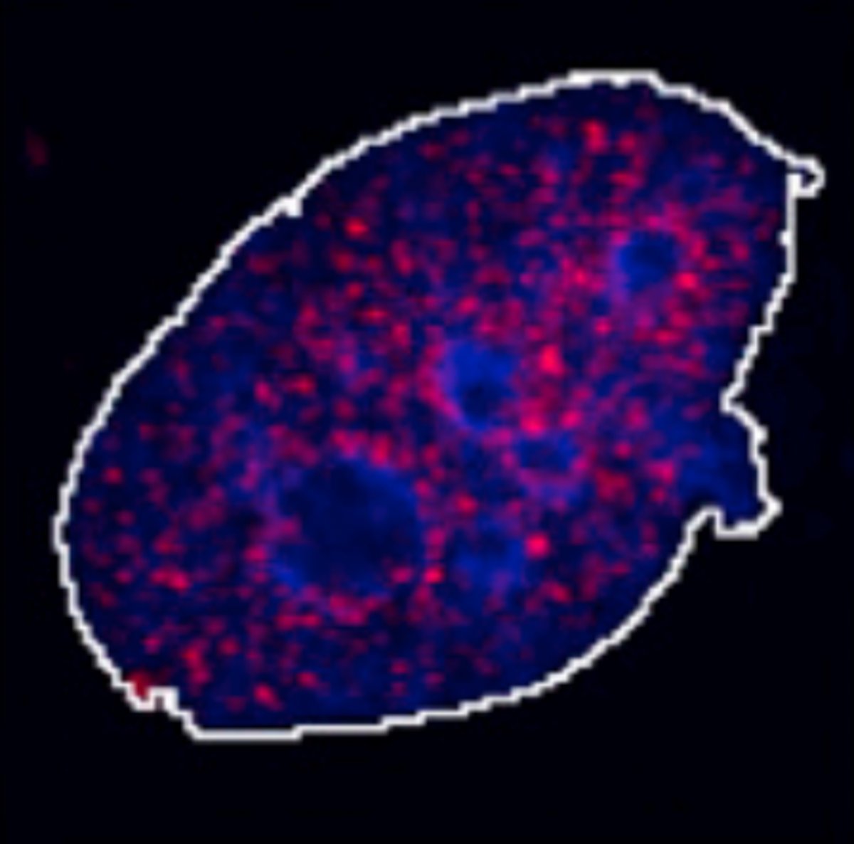 NTUsg's tweet image. Tagging along: Researchers from @UniofOxford and #NTUsg have uncovered the mechanism by which our cells identify and repair a highly toxic form of #DNA damage that causes #cancer, neurodegeneration, and premature #ageing.
These DNA lesions can result from chemotherapy, as well…